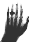 main de Rontgen
